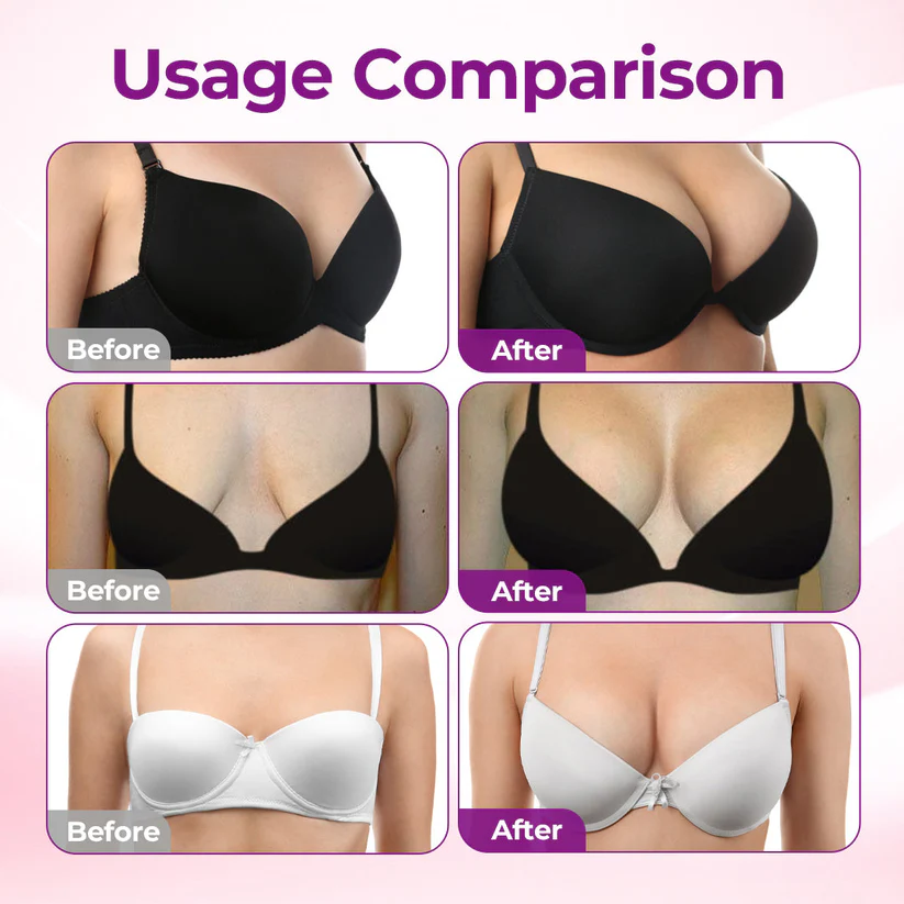 🔥LAST DAY 50% OFF - Alcuras® Targeted Breast Enhancement Advanced Nano Microneedle Patch