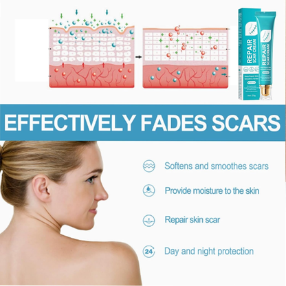 🔥Last Day 50% OFF - 🩹Alcuras® Advanced Scar Repair Cream✨