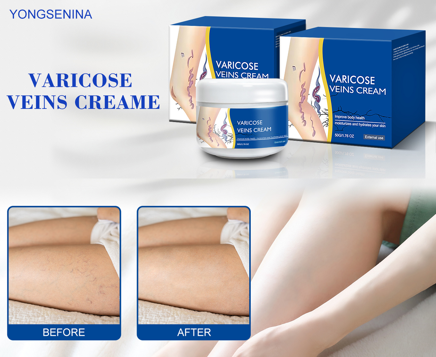 🎉Buy One Get One Free🎁 -Alcuras® Fast‑Absorbing Varicose Veins Care Cream For Smooth, Light, Confident Legs🦵