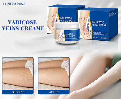 🎉Buy One Get One Free🎁 -Alcuras® Fast‑Absorbing Varicose Veins Care Cream For Smooth, Light, Confident Legs🦵