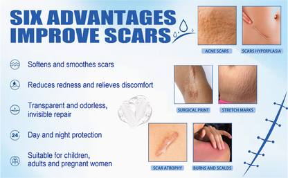 🔥Last Day 50% OFF - 🩹Alcuras® Medical Grade Silicone Scar Cream – Smooth Scars Fast!