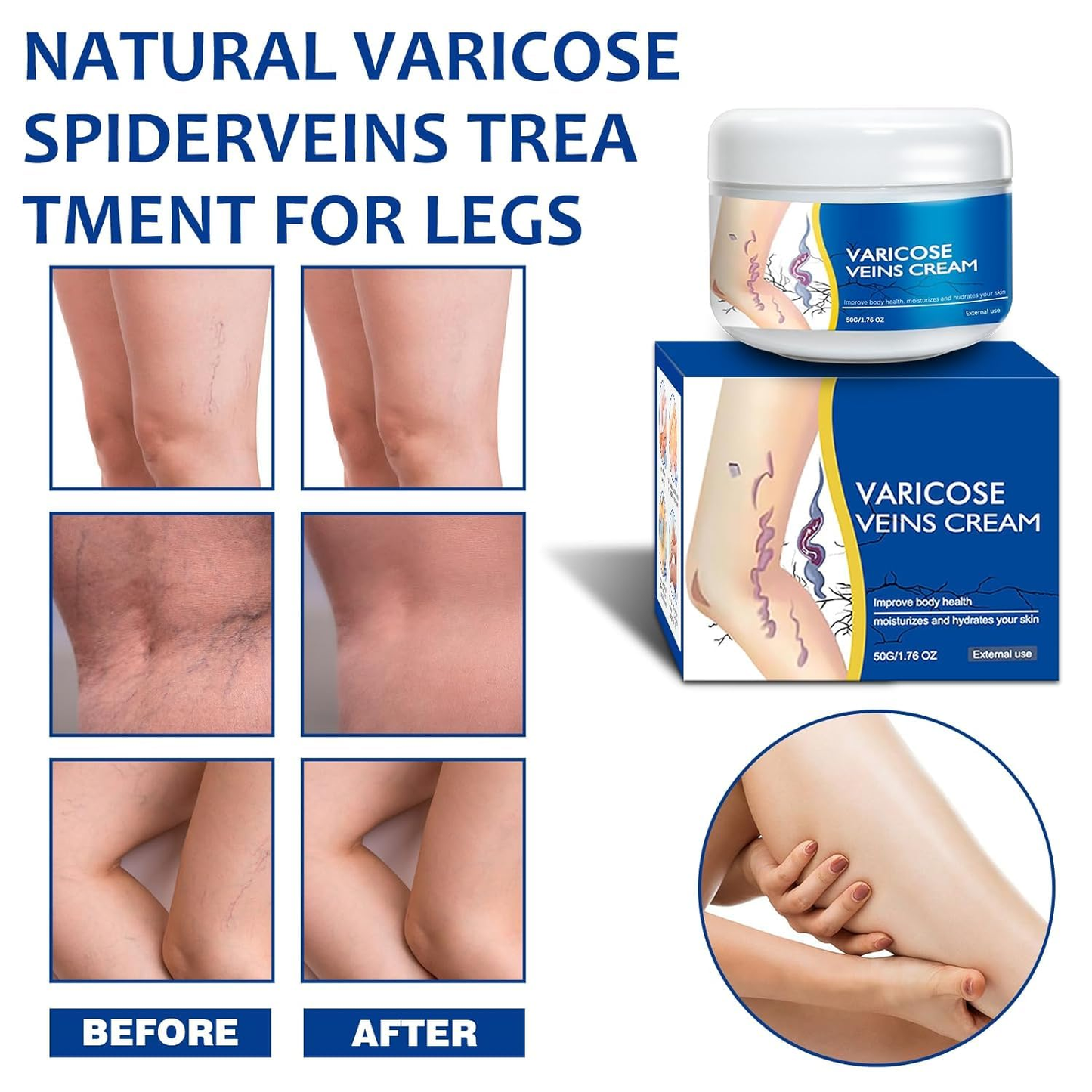 🎉Buy One Get One Free🎁 -Alcuras® Fast‑Absorbing Varicose Veins Care Cream For Smooth, Light, Confident Legs🦵