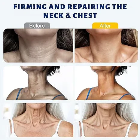 🎉Buy One Get One Free🎁 - Collagen Fullerene Tightening Neck Cream