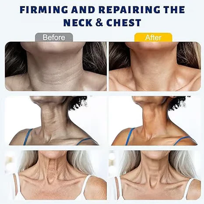 🎉Buy One Get One Free🎁 - Collagen Fullerene Tightening Neck Cream