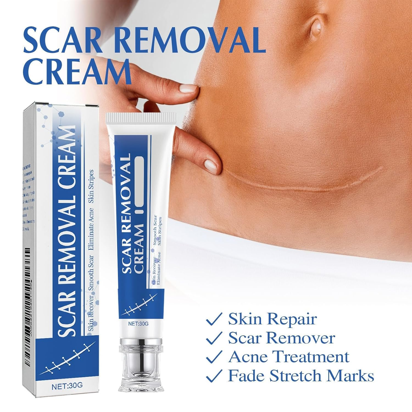 🔥Last Day 50% OFF - 🩹Alcuras® Medical Grade Silicone Scar Cream – Smooth Scars Fast!