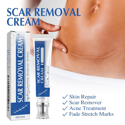 🔥Last Day 50% OFF - 🩹Alcuras® Medical Grade Silicone Scar Cream – Smooth Scars Fast!