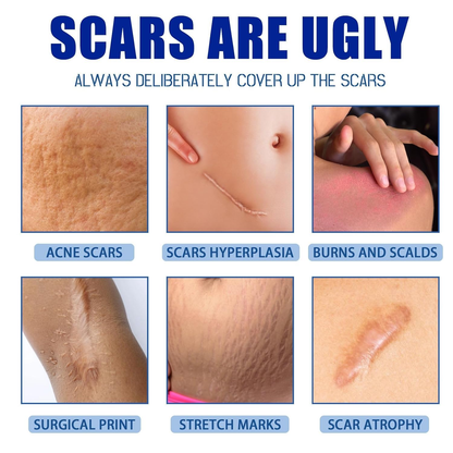 🔥Last Day 50% OFF - 🩹Alcuras® Medical Grade Silicone Scar Cream – Smooth Scars Fast!